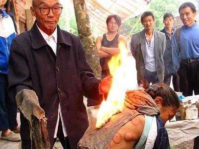 拔罐2.jpg
